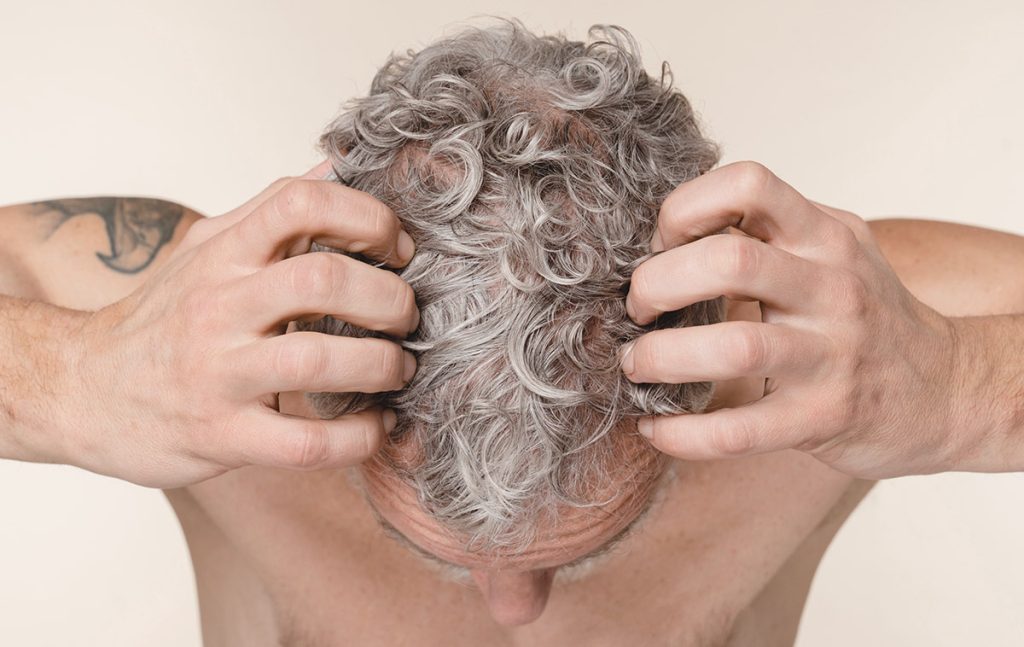 Cuir chevelu irrité