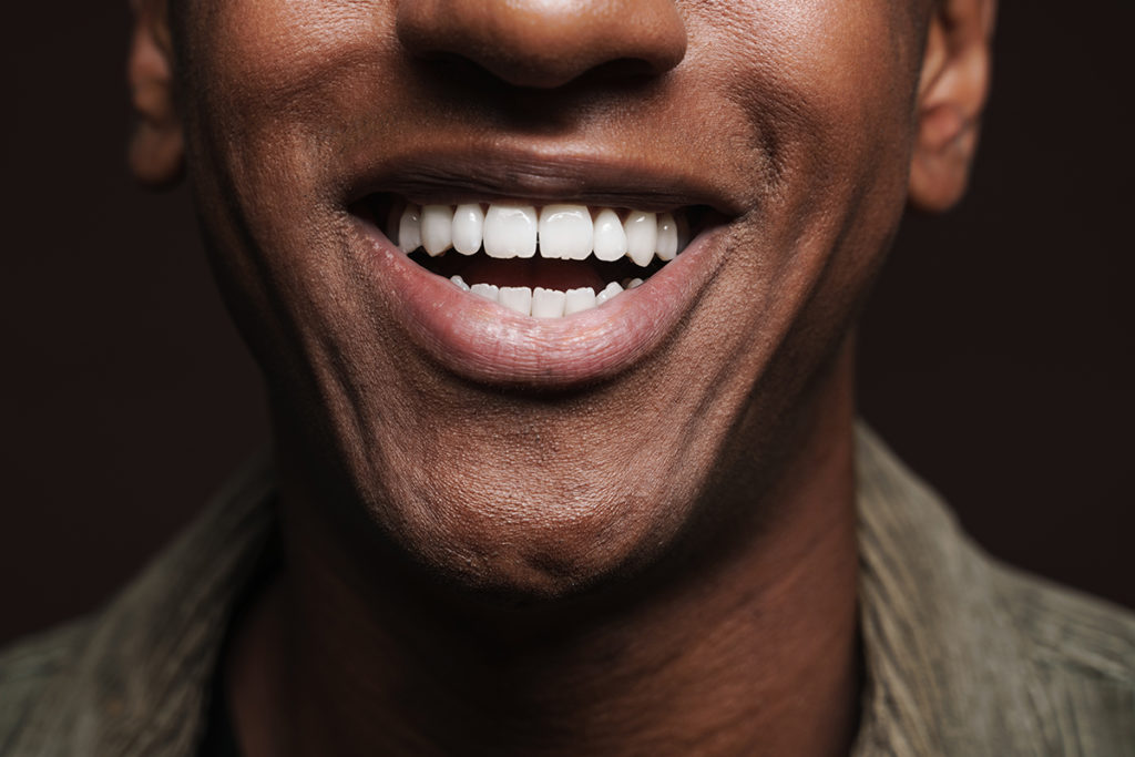 Comment avoir des dents blanches ?