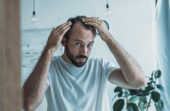 Perte de cheveux chez l'homme