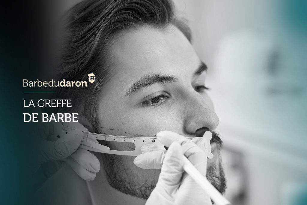 La greffe de barbe