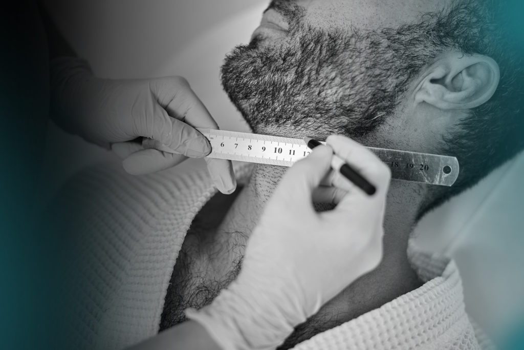 greffe de barbe 2