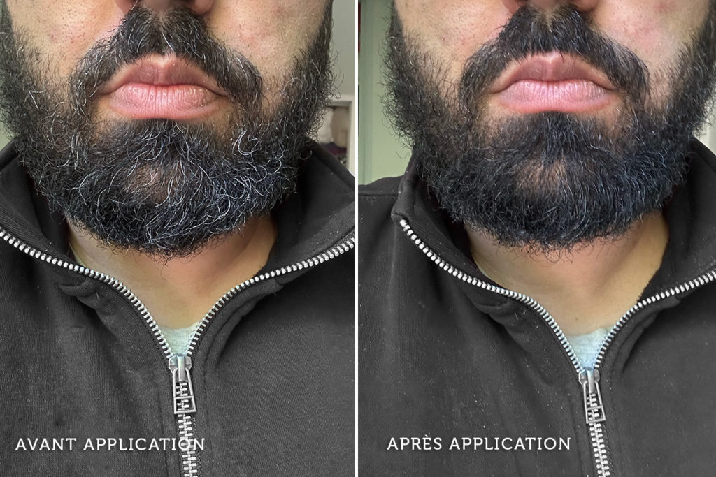 Avant / Après Correcteur de barbe Cryom