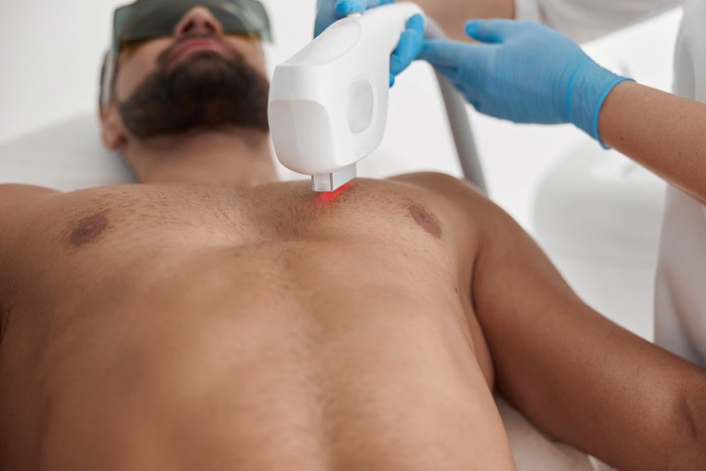 Epilation laser torse pour homme