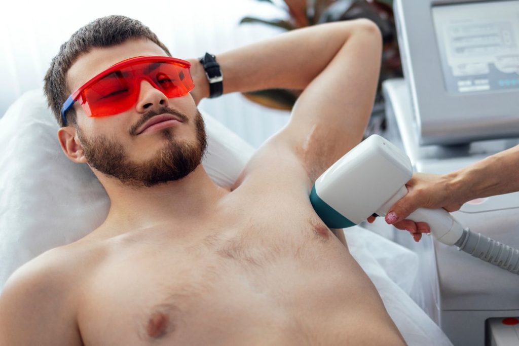Epilation laser pour homme