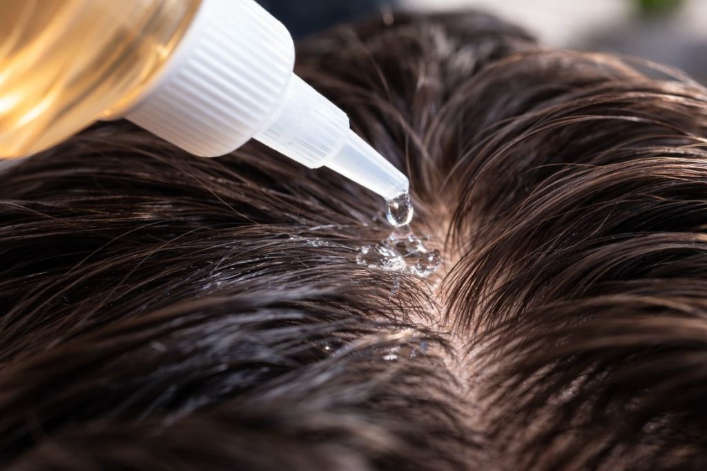 Acide Glycolique et cuir chevelu