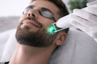 L’épilation laser de la barbe et de la moustache