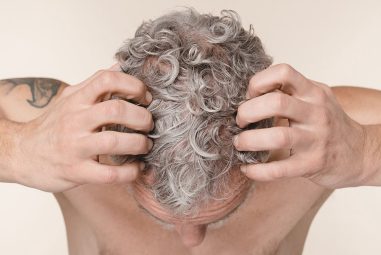 Cuir chevelu irrité : que faire ?